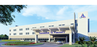 rendering ascension st. vincent's